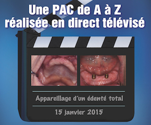 une PAC en direct télévisé