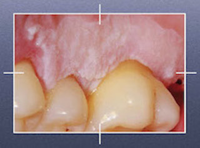 Journée Dermatologie buccale - SOP