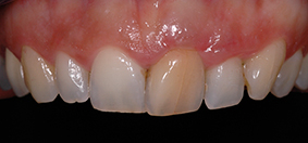 dentisterie esthétique fig.2
