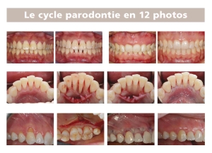 le cycle parodontie en 12 photos