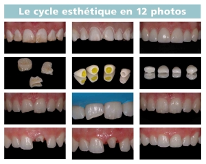 le cycle en 12 photos