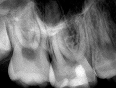 Cas n° 2 : Radiographie à 12 mois.