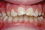 Fig. 1. Cas 1 : Traitement par rééducation fonctionnelle.