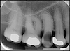 radiographie 1