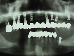 6. Cas clinique 4 – Radiographie panoramique.