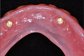 Fig.2 - PACSI.