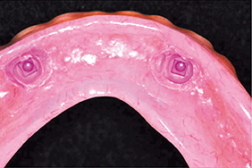 Fig.8 - Empreinte de PACSI (pour le positionnement des attachements par le laboratoire).