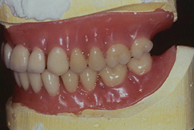 Fig.10 - Essayage fonctionnel et esthétique.