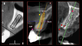 5 - Analyse scanner par différents moyens.