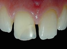 cas clinique 1
