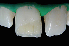 cas clinique 3
