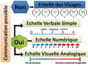 Tableau numéro 2 - La douleur inflammatoire aiguë : physiopathologie – évaluation – prise en charge