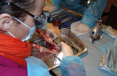 TP 10 - Chirurgie parodontale : renforcer les dents et implants