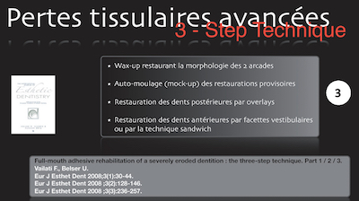 figure 3 - Alain Vanheusden : « 3-Step technique »