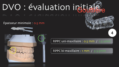 figure 4 - Alain Vanheusden : DVO et évluation initiale