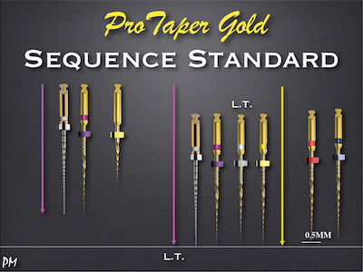 N° 2 : Séquence Protaper Gold