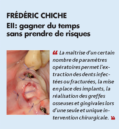 Thème n°6 par FRÉDÉRIC CHICHE > EII : gagner du temps sans prendre de risques