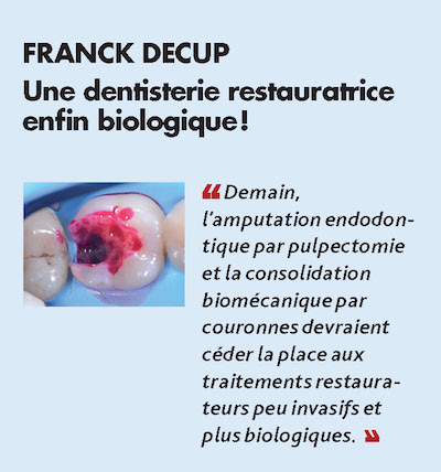 Thème n°2 par FRANCK DECUP > Une dentisterie restauratrice enfin biologique !