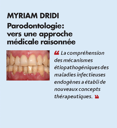 Thème n°11 par MYRIAM DRIDI > Parodontologie : vers une approche médicale raisonnée