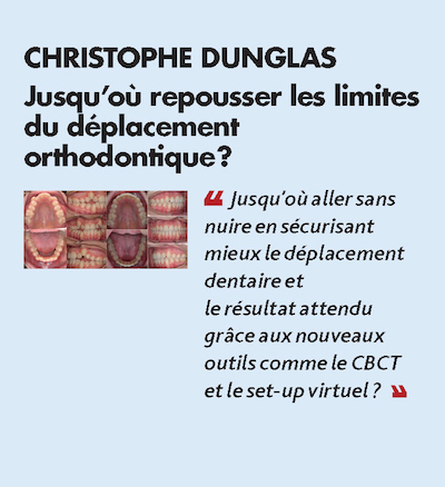 Thème n°9 par CHRISTOPHE DUNGLAS > Jusqu’où repousser les limites du déplacement orthodontique ?