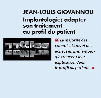 Thème n°10 par JEAN-LOUIS GIOVANNOLI > Implantologie : adapter son traitement au profil du patient 