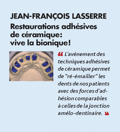 Thème n°7 par JEAN-FRANÇOIS LASSERRE > Restaurations adhésives de céramique : vive la bionique !