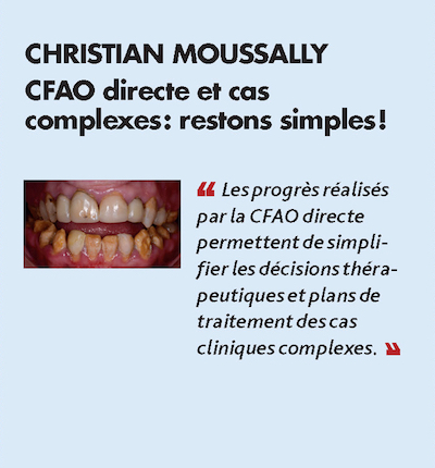 Thème n°5 par CHRISTIAN MOUSSALLY > CFAO directe et cas complexes : restons simples !