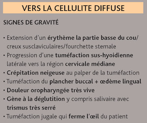 Les cellulites cervico-faciales