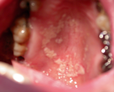 Tout ce qu'il faut savoir des Urgences Dentaires Infectieuses ...