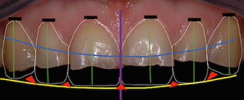 Cycle long en dentisterie esthétique 2015