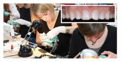 Cycle long en dentisterie esthétique 2016