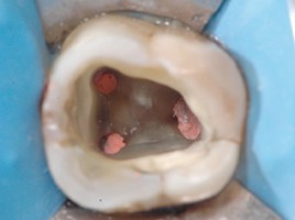 Endodontie 2025-2026