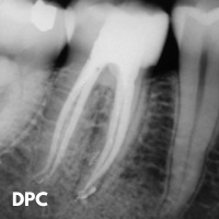 Endodontie 1 jour DPC 2024