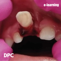 Odontologie pédiatrique V2 DPC 2024