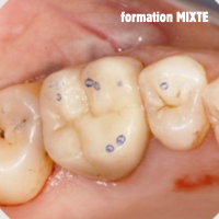 Occlusodontie en pratique, actualisation, simplification 2026