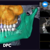 CBCT :  comprendre, bien choisir, traiter grâce à l'imagerie 3D