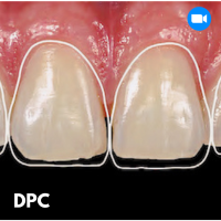 La photographie en odontologie