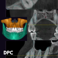 CBCT Comprendre, Bien Choisir, Traiter grâce à l'imagerie 3D - Formation Validante DPC 2026