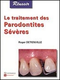 Le traitement de parodontites sévères