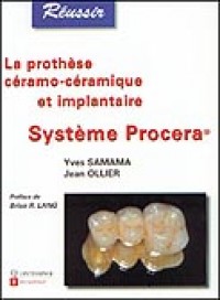 La prothèse ceramo-céramique et implantaire : Système Procera®