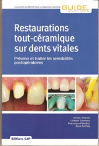 Restaurations tout-céramique sur dents vitales 