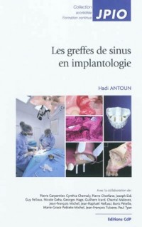 Les greffes de sinus en implantologie