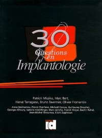 30 questions en implantologie