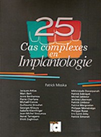 25 cas complexes en implantologie