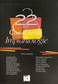 22 cas d'école en implantologie