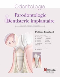 Parodontologie et dentisterie implantaire. Volume 1 médecine parodontale.