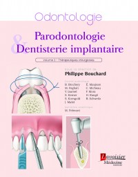 Parodontologie et dentisterie implantaire, volume 2 : Thérapeutiques chirurgicales 
