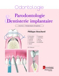 Parodontologie et dentisterie implantaire, volume 2 : Thérapeutiques chirurgicales 