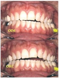 L'occlusodontie