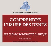 Comprendre l'usure des dents